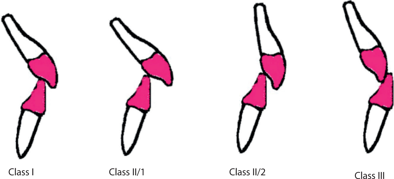 14+ Class One Orthodontics