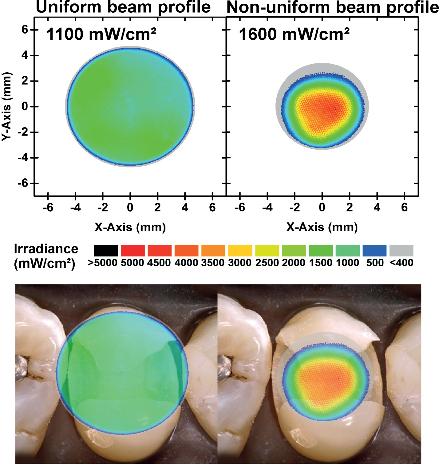 Figure 2 from Light-curing considerations for resin-based