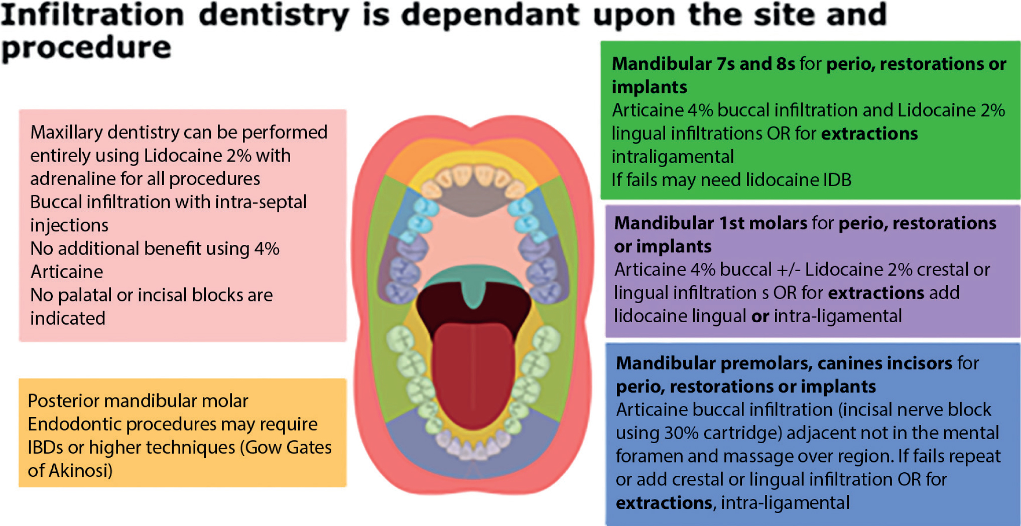 Dental Malpractice Central  Inferior Alveolar Nerve Anatomy